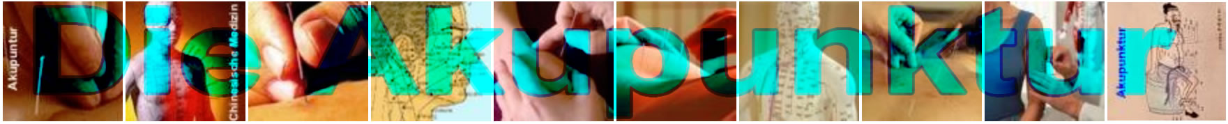 Die Laserakupunktur zur Ergänzung von Systemischer Aufstellung und Coaching - owi die Aufsteller - www.ch-aufstellungen